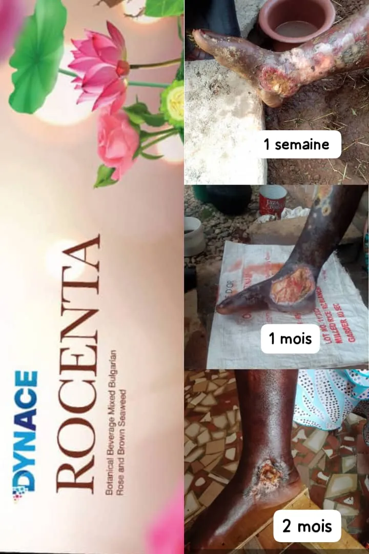 Image 5 de Vente des compléments alimentaires